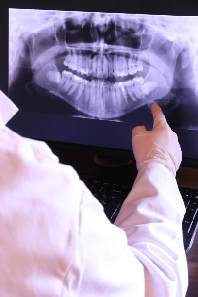 Best Emergency Treatment for Dental Infections or Abscesses in Cherry Brah, NC
