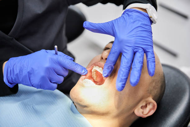 Best Emergency Tooth Extraction in Cherry Brah, NC